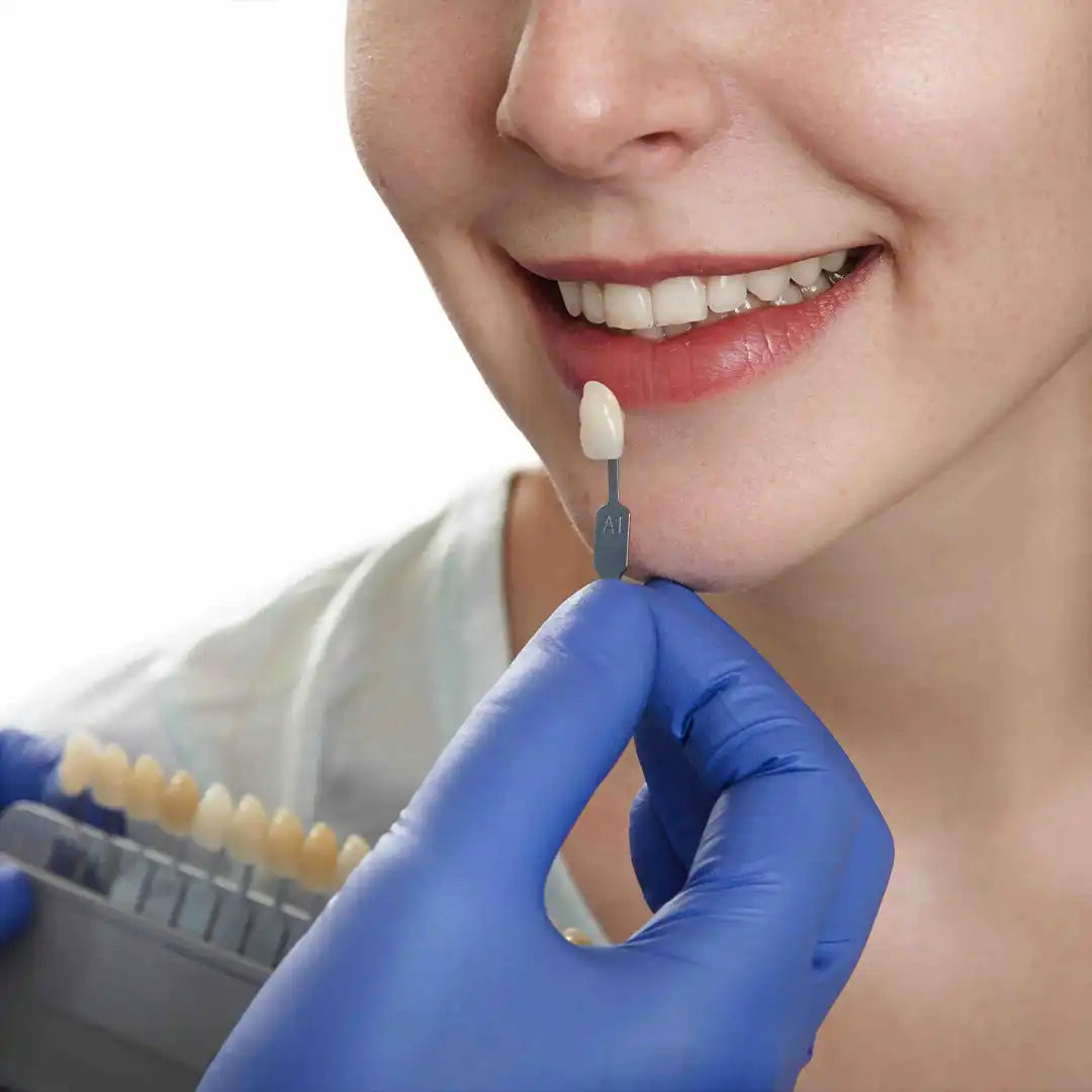 Corona de Zirconia